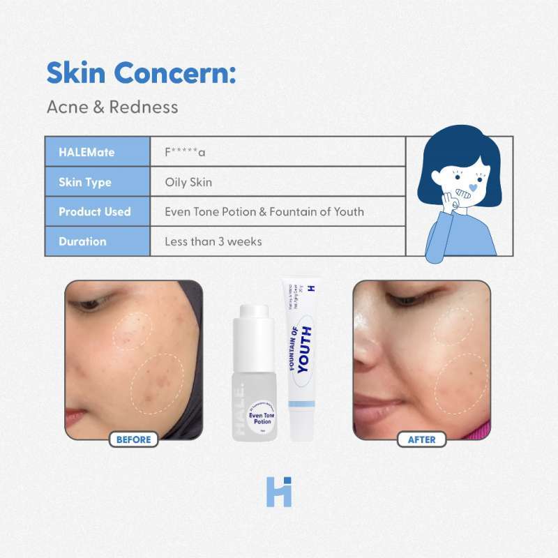 HALE FOUNTAIN OF YOUTH 20 GR