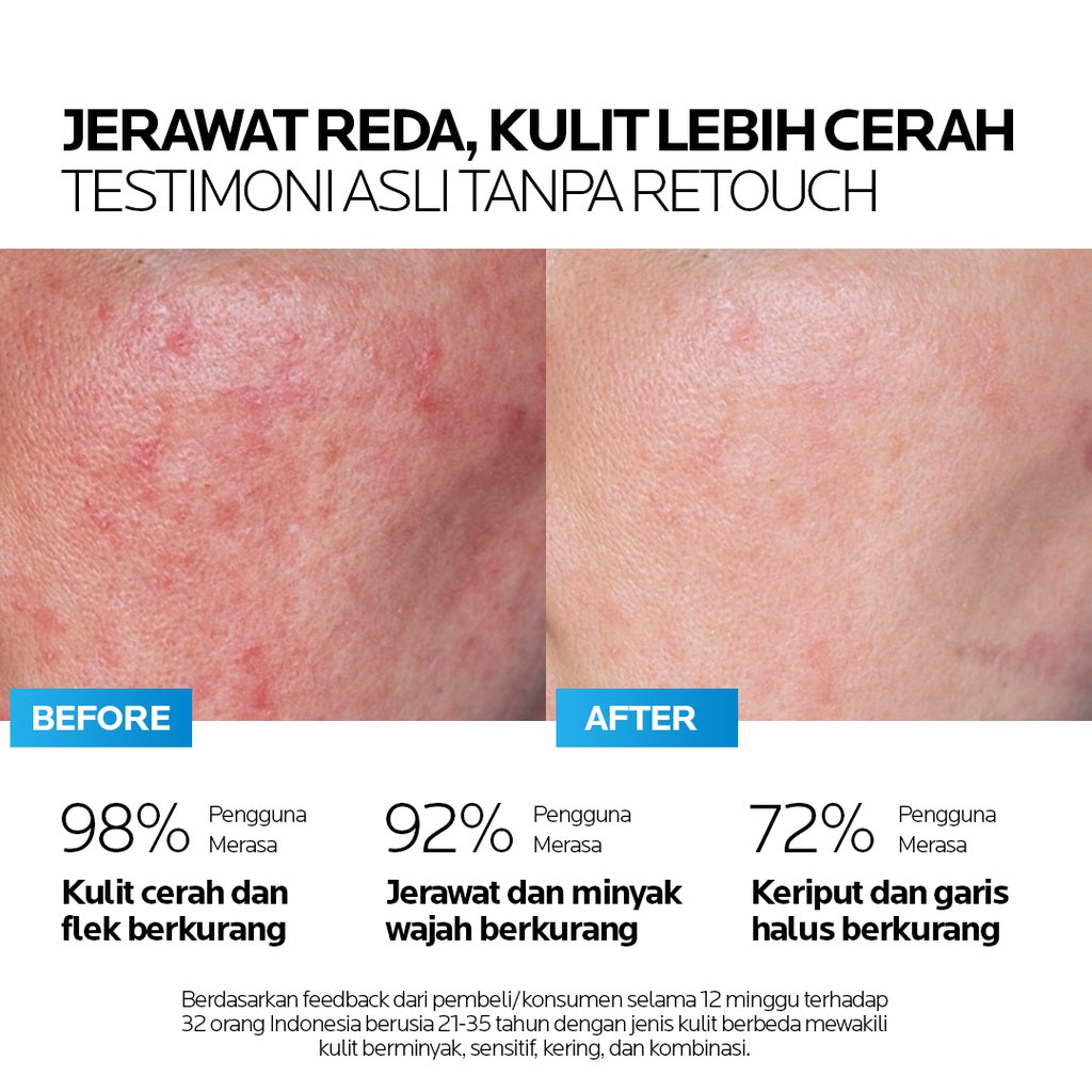 AIZEN PHYTOREVITA RETINAPEPTIDE AMPOULE ESSENCE 20ML