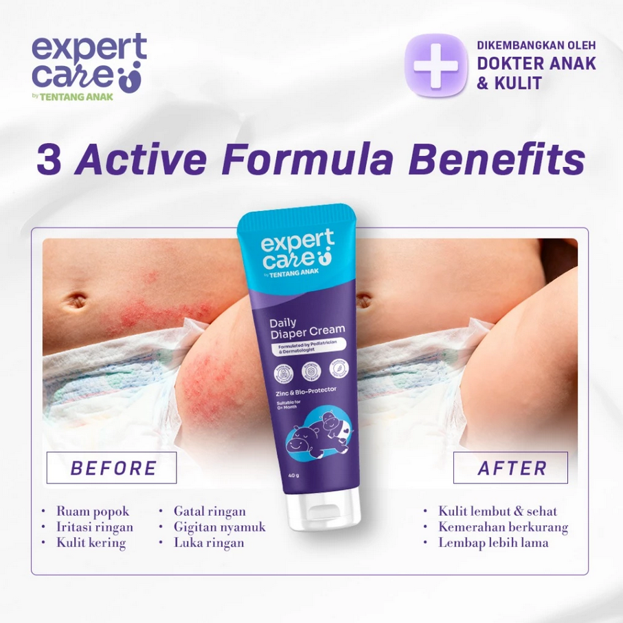 EXPERT CARE DAILY DIAPER CREAM 40 GR
