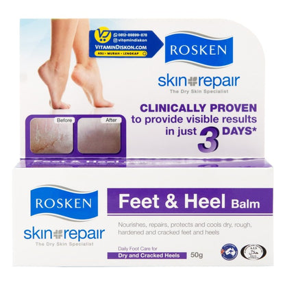ROSKEN FEET DAN HEEL BALM 50 GR