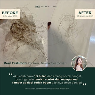 REE DERMA HOT OIL HAIR & SCALP TREATMENT 100ML