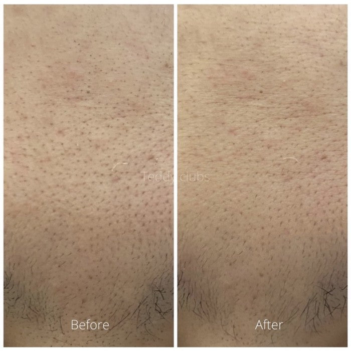 TEDDY CLUBS BOBA PORE CARE 30GR