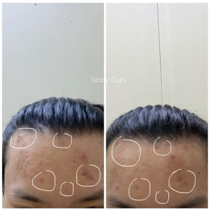 TEDDY CLUBS MATCHA CLAY MASK 100GR