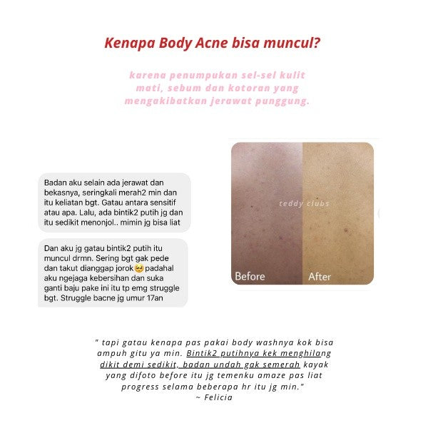 TEDDY CLUBS BHA BACNE BALANCING BODY WASH 236ML