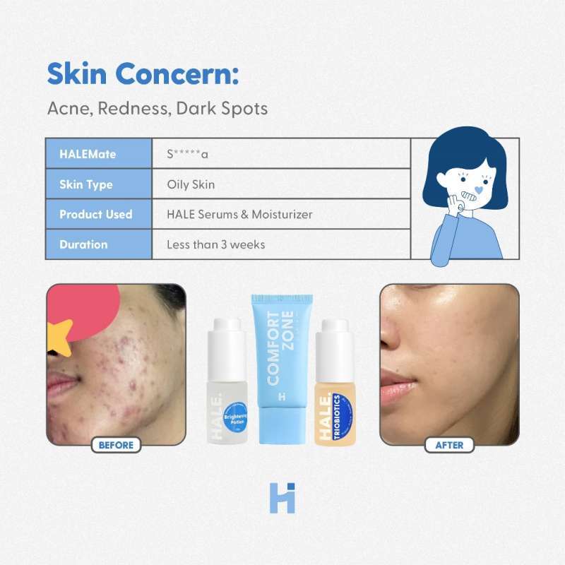 HALE TRIOBIOTICS 15 GR