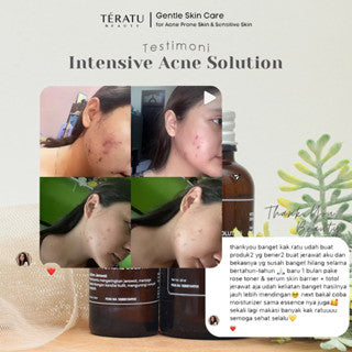 TERATU BEAUTY INTENSIVE ACNE SOLUTION 30ML