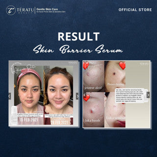 TERATU BEAUTY SKIN BARRIER SERUM 30ML