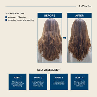 EUCALIE ORGANIC HAIR GROWTH OIL AND SCALP TREATMENT POWER 10+ 45ML