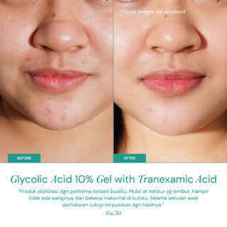 FOR SKIN'S SAKE FSS GLYCOLIC ACID GEL 10% WITH TRANEXAMIC ACID 100ML