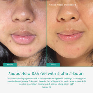 FOR SKIN'S SAKE FSS LACTIC ACID GEL 10% WITH ALPHA ARBUTIN 100ML