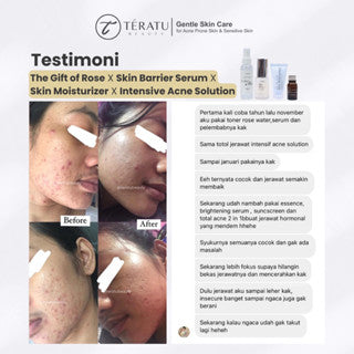 TERATU BEAUTY THE GIFT OF ROSE SOOTHING AND BRIGHTENING TONER SPRAY 100ML