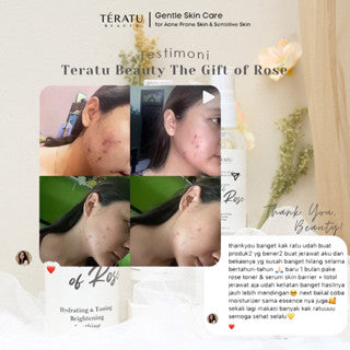 TERATU BEAUTY THE GIFT OF ROSE SOOTHING AND BRIGHTENING TONER SPRAY 100ML