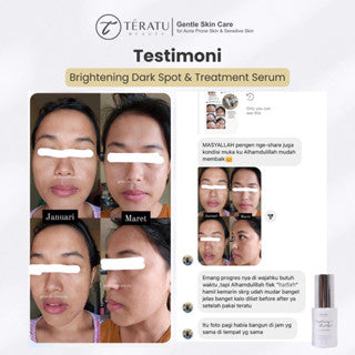 TERATU BEAUTY BRIGHTENING AND DARK SPOT TREATMENT 30ML