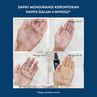 EUCALIE ORGANIC HAIR GROWTH OIL AND SCALP TREATMENT POWER 10+ 45ML