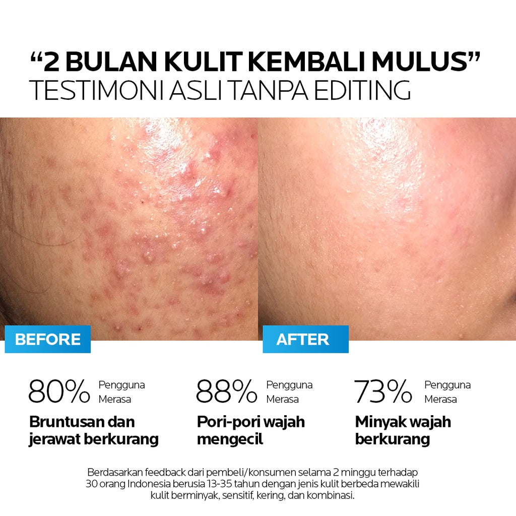 AIZEN ACNEFIQUE V2.0 CREAM 20GR