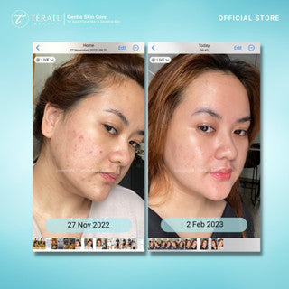 TERATU BEAUTY BRIGHTENING AND DARK SPOT TREATMENT 30ML