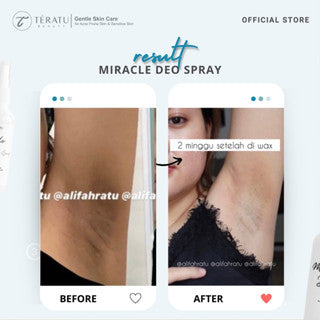 TERATU BEAUTY MIRACLE DEO SPRAY DEODORANT 60ML