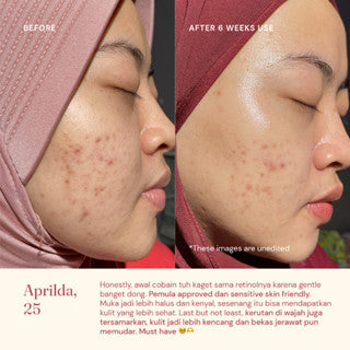 FOR SKIN'S SAKE FSS RETINOL SERUM 0.15% WITH CERAMIDE III 30ML