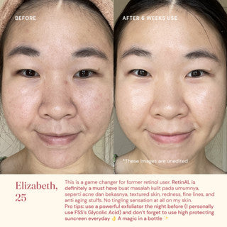 FOR SKIN'S SAKE FSS RETINAL SERUM 0.15 WITH SAMPHIRA OIL 30ML