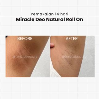 TERATU BEAUTY MIRACLE DEO NATURAL ROLL ON 50ML