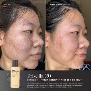 FOR SKIN'S SAKE FSS SALICYLIC ACID TONER 2% WITH SUCCINIC ACID 100 ML