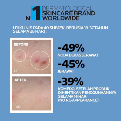 LA ROCHE POSAY EFFACLAR SERUM ULTRA CONCENTRE ANTI IMPERFECTION AND MARKS DAILY PEELING 30 ML